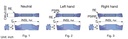 IMAGEN_6860385